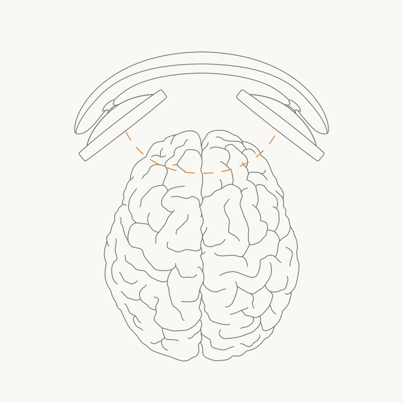 Animated illustration of the Flow headset stimulating the brain (tDCS)